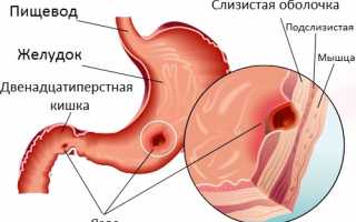 Болит живот сердце спина