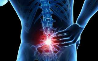 Седалищный нерв болит спина справа