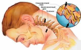Болит шея и правая сторона спины
