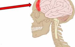 Болит голова лобная часть что