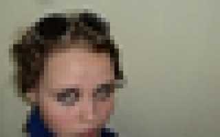 Вчера пил сегодня болит голова