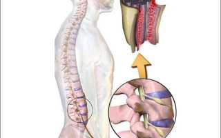 Болит спина справа от позвоночника почему