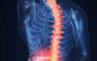 Болит спина как правильно сидеть