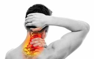 Защемление в шейном отделе позвоночника болит голова