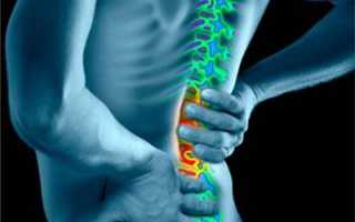 Болит спина и отдает в пах у женщин