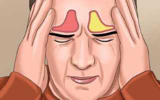 Болит голова от фронтита