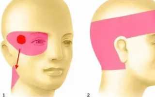 Болит один глаз и голова что делать