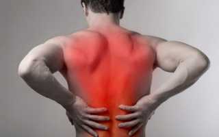 С перепоя болит спина