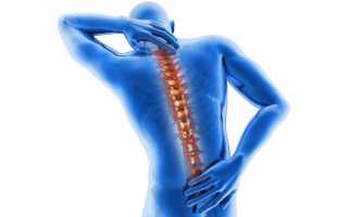 Происхождение болей в спине