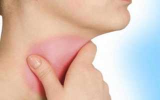 Болит голова зубы горло но температуры нет