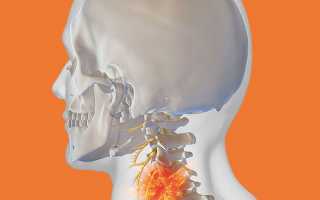 Ноют руки шея болит голова