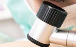 Чешется и болит родинка на голове