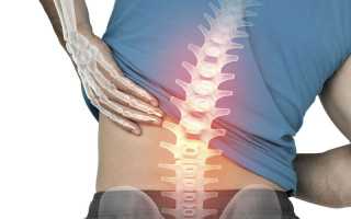 Долго не могу стоять болит спина что делать