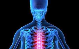 Болит середина спины что делать