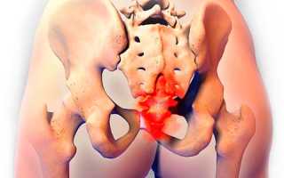 Если болит копчик когда сидишь или лежишь на спине