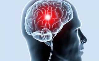 Постоянно болит голова что это за болезнь