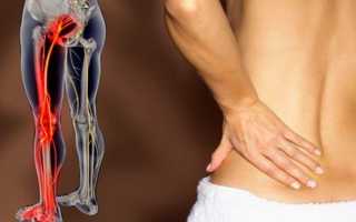 Болит внизу спины и отдает в ногу