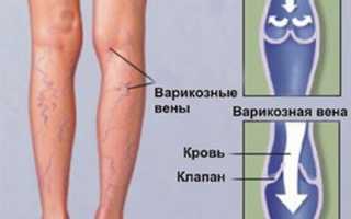 Почернела нога и болит спина