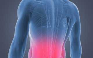 Может от зарядки болеть спина