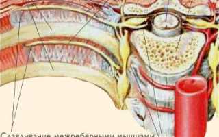 Болит спина немеет левая сторона
