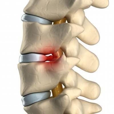 болит спина и отдает в пах у женщин