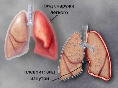 Что может болеть в правом боку отдает в спину