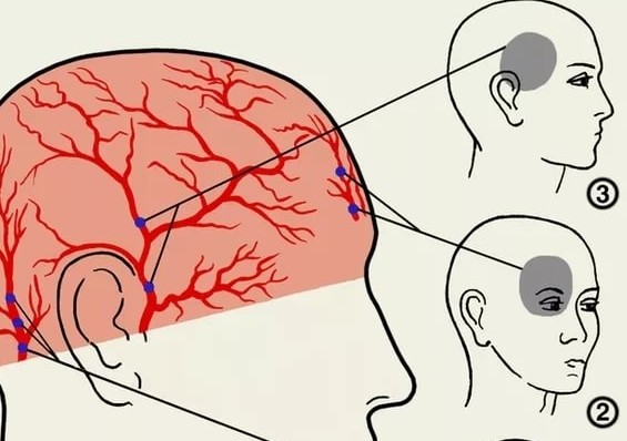 Постоянно болит голова и глаза что это