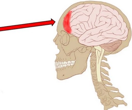 Болит голова лобная часть что