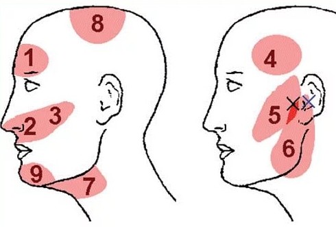 Сильно болит голова и вески