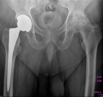 болит спина и отдает в пах у женщин