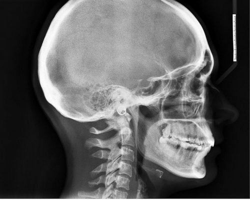 Когда я встаю у меня болит голова