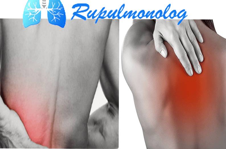 Боль в спине при кашл