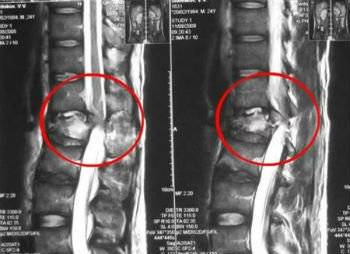 Если при наклоне головы болит спина