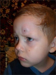 Внешние повреждения