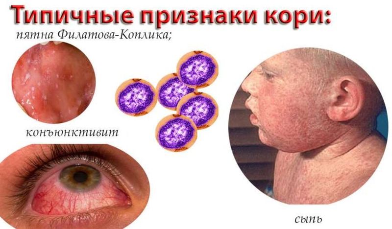 Болит голова и на лице появилась сыпь