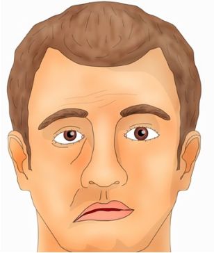 Болит голова при шевелении головой