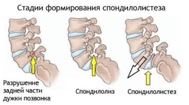 болит спина спать не возможно