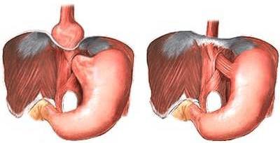 из за чего болит спина у девушки с левой стороны