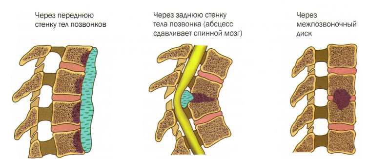 Спина устает и болит
