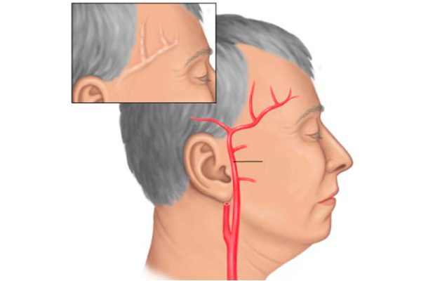 Сильно болит голова таблетки не помогают что делать