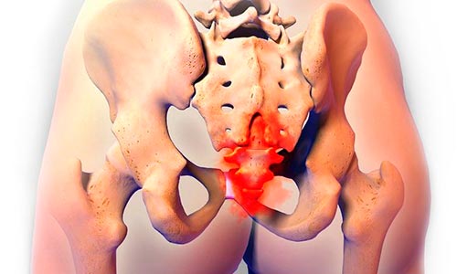 Если болит копчик когда сидишь или лежишь на спине