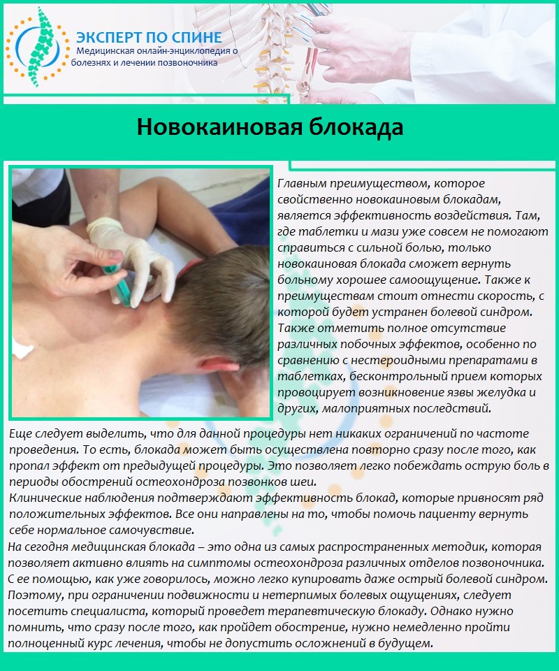 Новокаиновая блокада