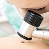 Почему могут чесаться родинки