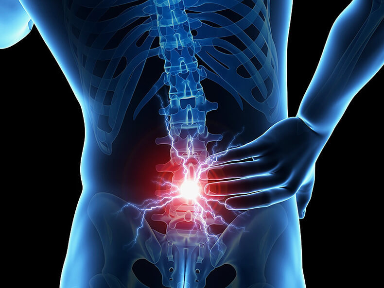 ИШИАС и БОЛИ в ПОЯСНИЦЕ: ЧТО ДЕЛАТЬ ИШИАС и БОЛИ в ПОЯСНИЦЕ: ЧТО ДЕЛАТЬ