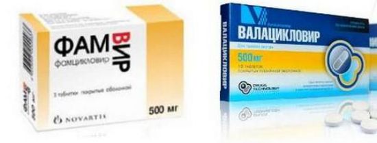 Герпес болит кожа головы