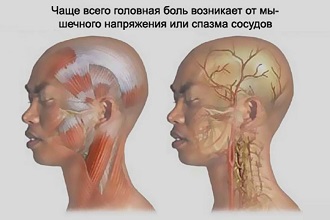 Головная боль от мышечного напряжения и спазма сосудов Головная боль от мышечного напряжения и спазма сосудов