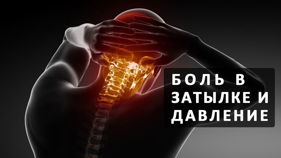 Сильно болит затылок головы какую таблетку выпить