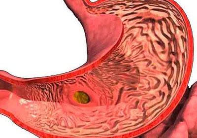из за чего болит спина у девушки с левой стороны