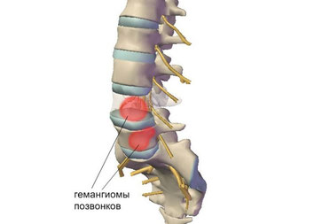 Долго не могу стоять болит спина что делать