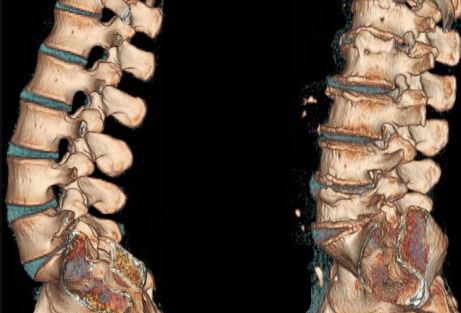 Спина устает и болит